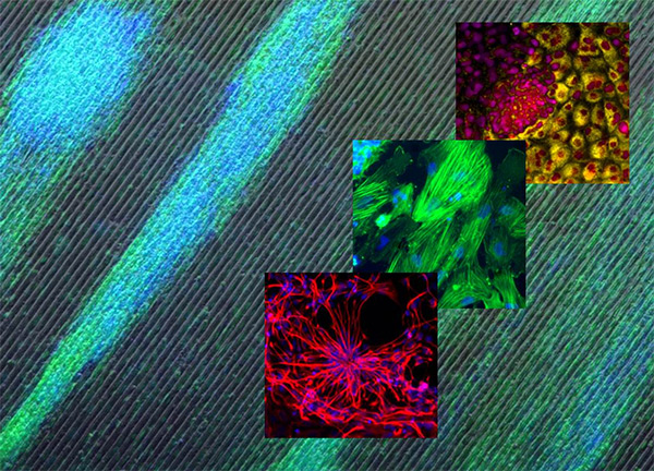 Fibroblasts grown on parallel grooves
